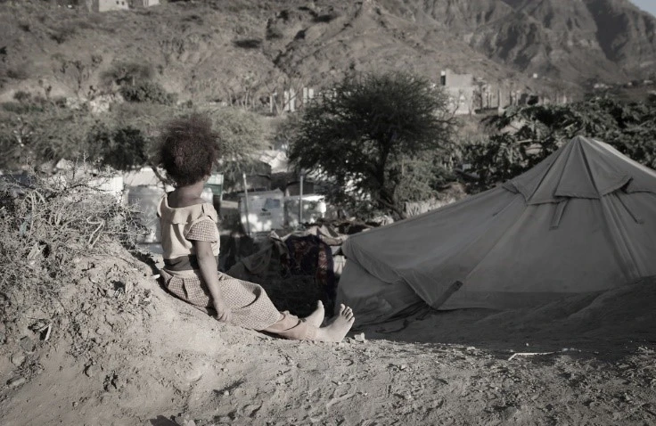 Young malnourished child sitting down.